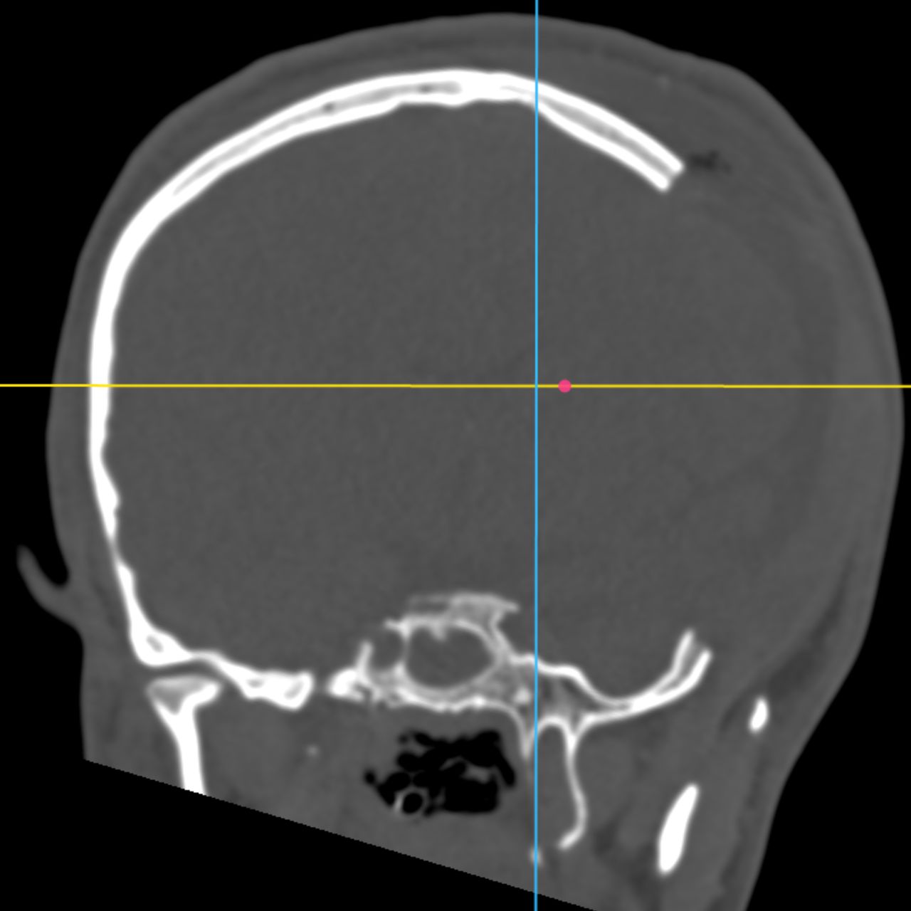 David Tafur Muñoz-2226