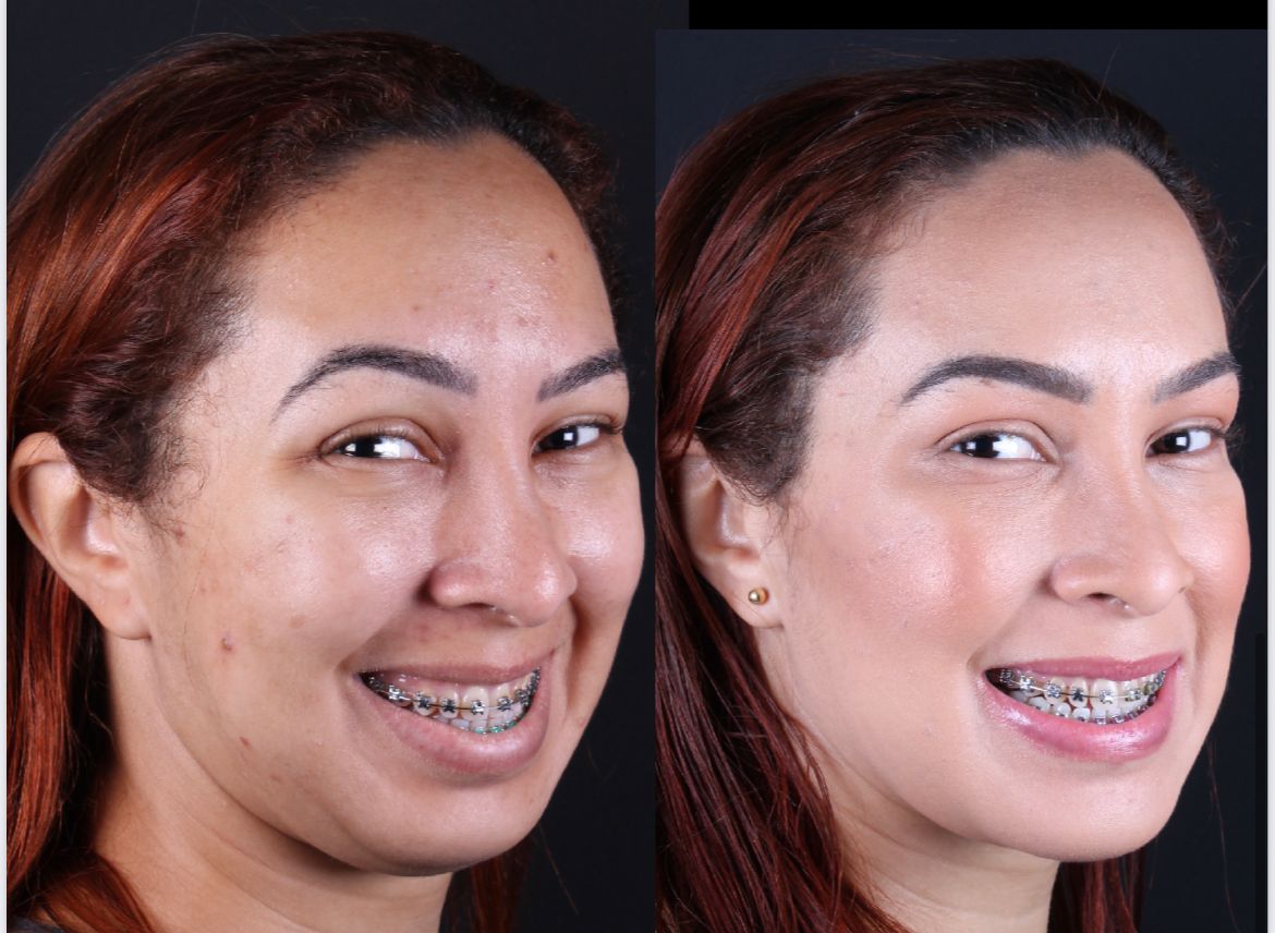 Frederico Carnevale-4