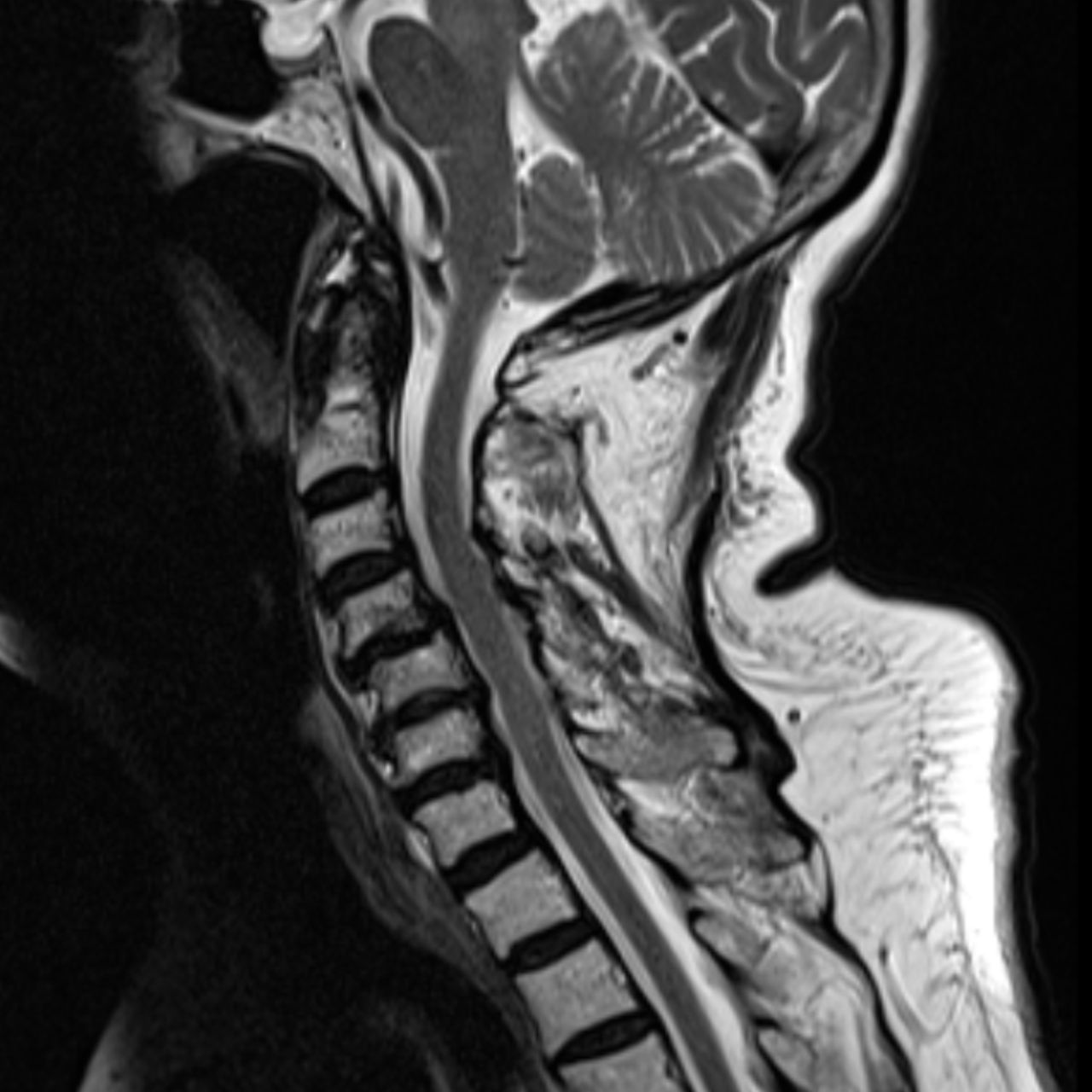 David Tafur Muñoz-1468