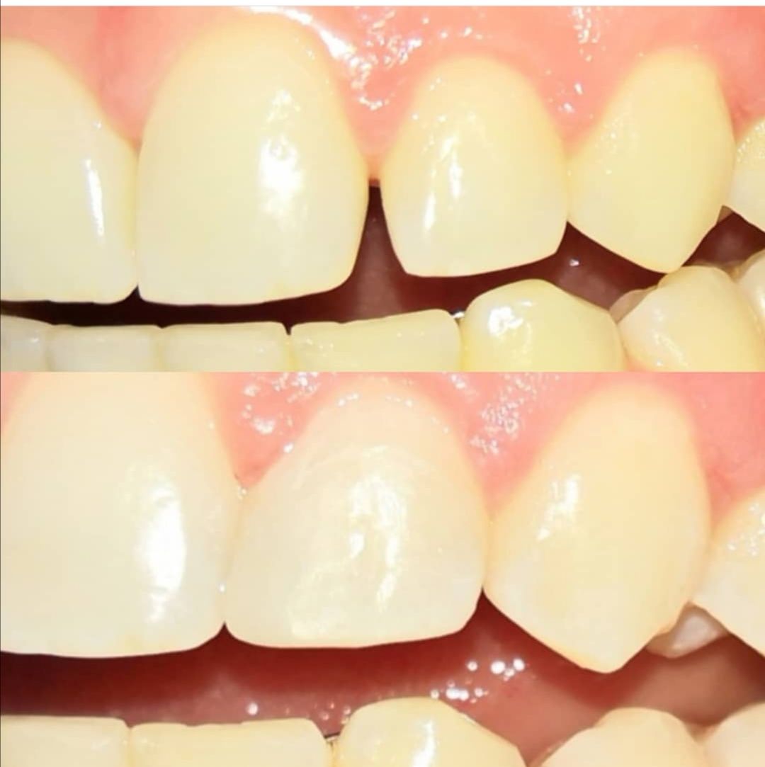 Marivaldo Fogaça-13