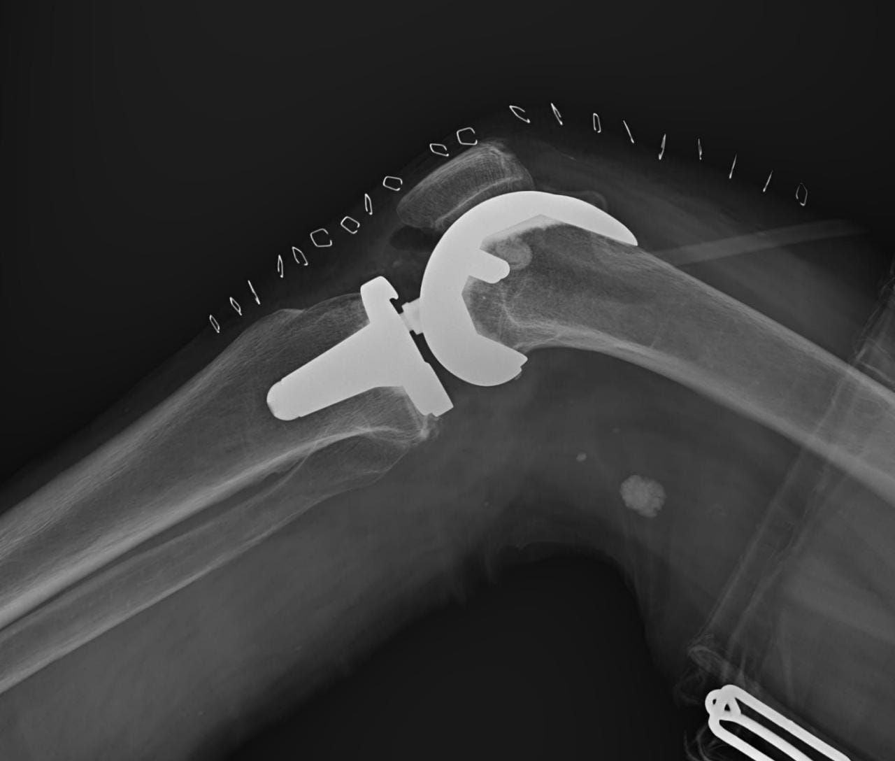 Carlos Escalante Saavedra-3