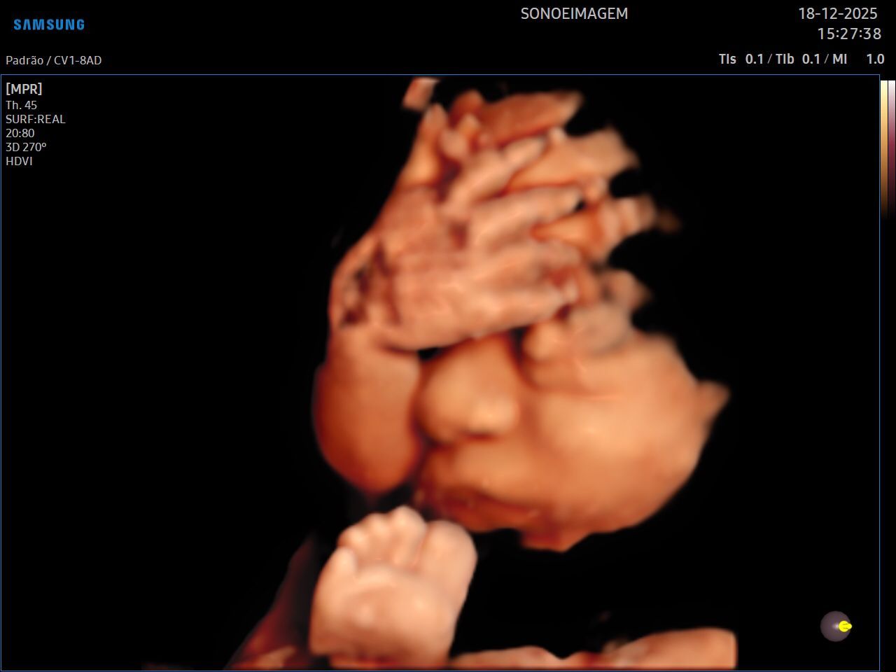 Gontran Tôrres Fróes-1