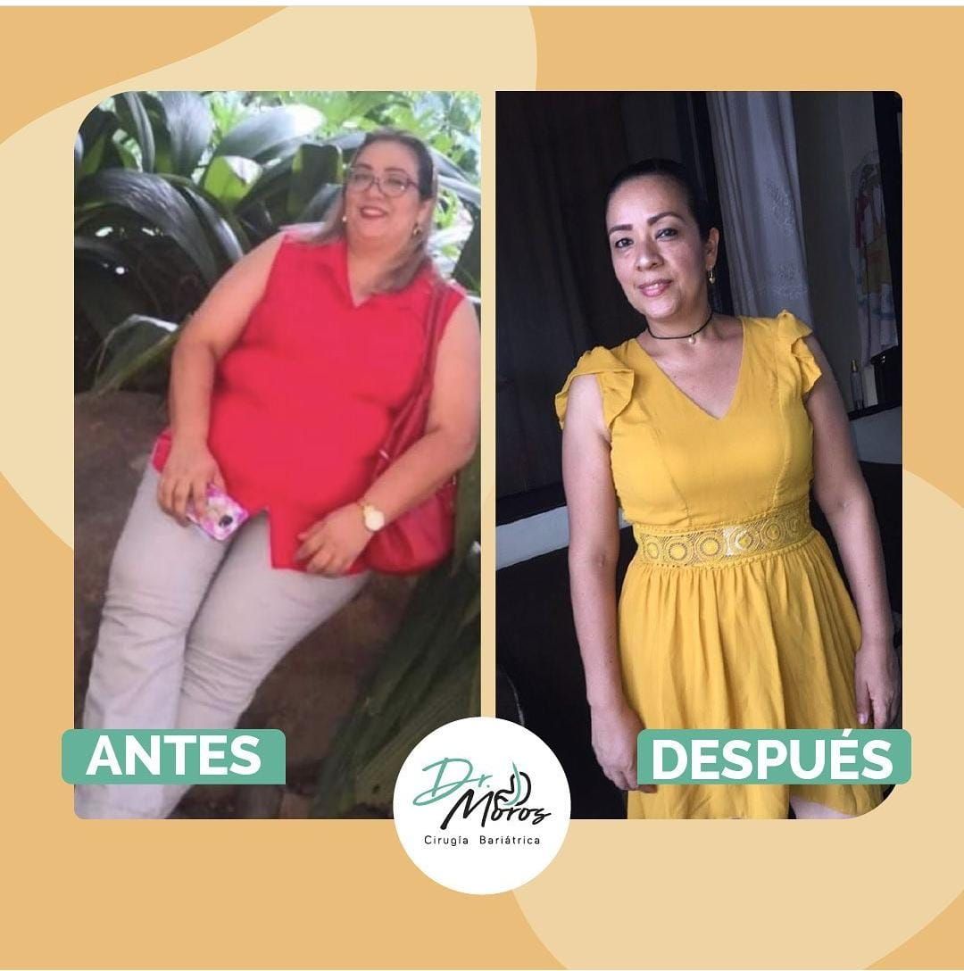 J. Gonzalo Moros I.-3