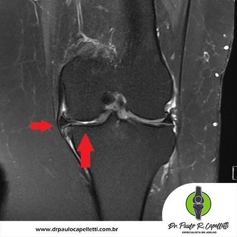 Paulo Roberto Capelletti-29