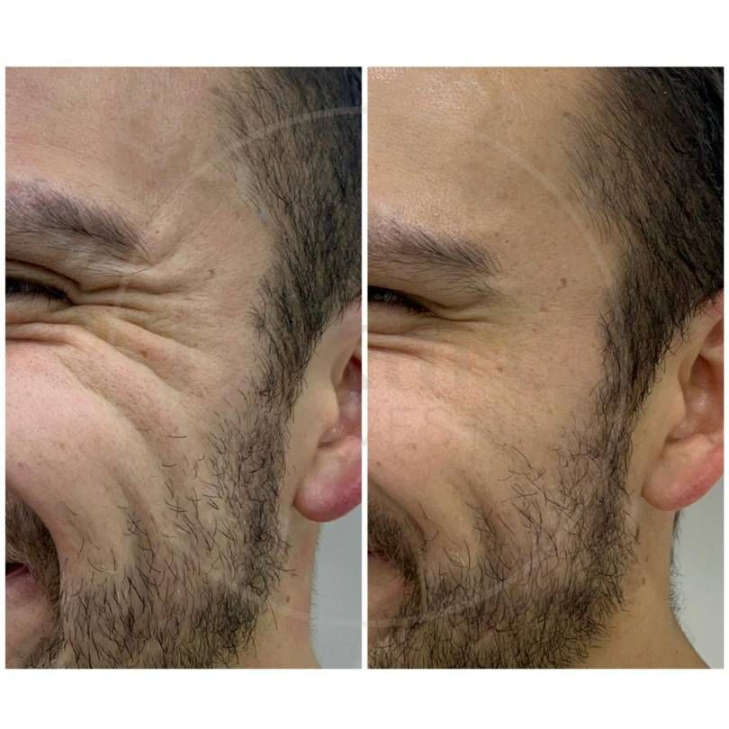 Oscar Iván Lozano Navarrete-5