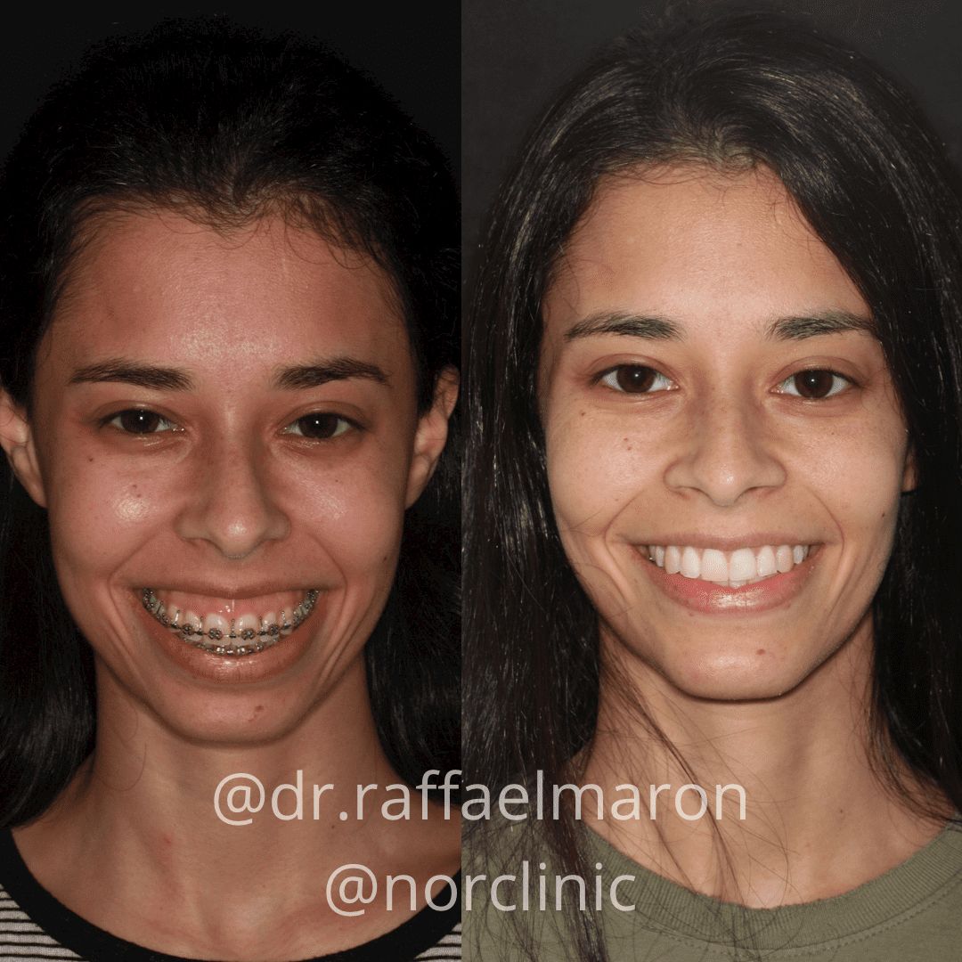 Raffael Maron Vieira De Noronha-1