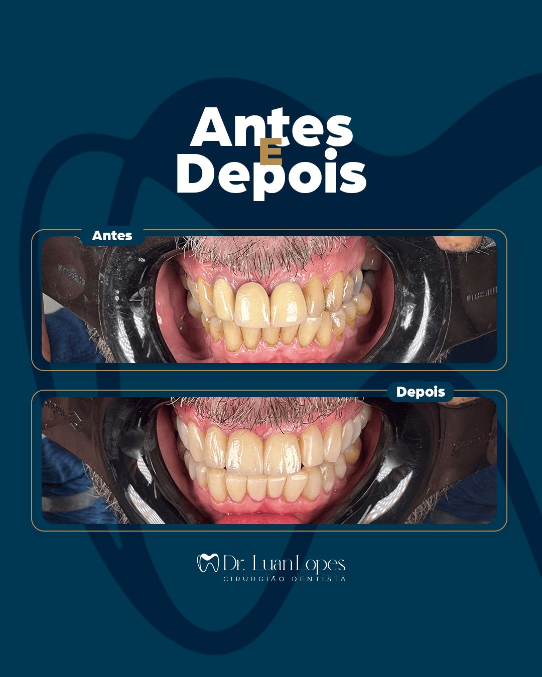 Luanderson Lopes Pereira-10