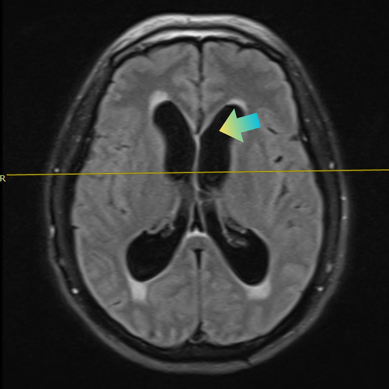 David Tafur Muñoz-2405