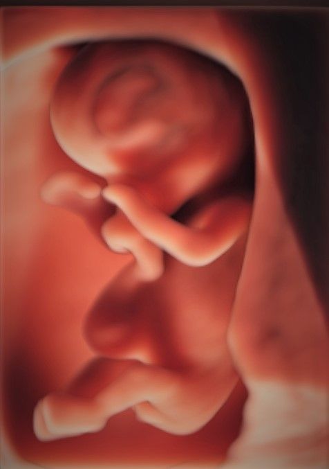 Charles Schwantz De Lima-7