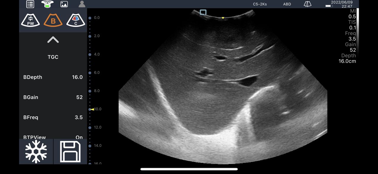 Alexander Alonso Lázaro Chumbe-3