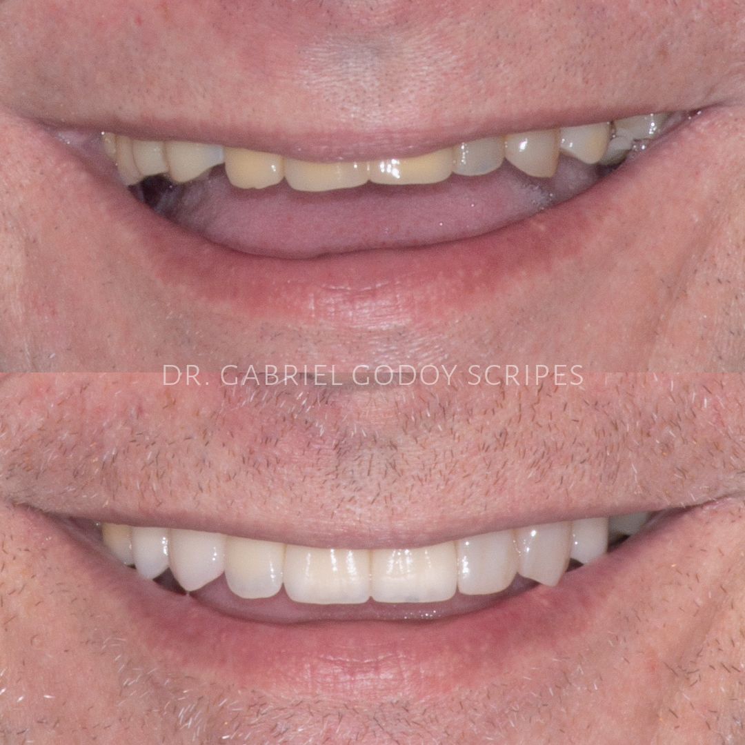 Gabriel Godoy Scripes-9