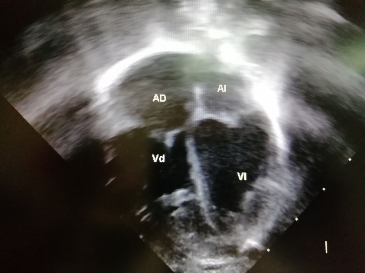 José Flores Higuita-11