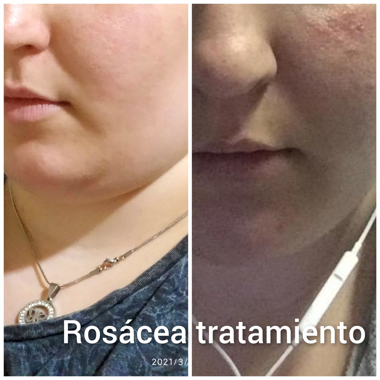 Alejandra Meijide-31