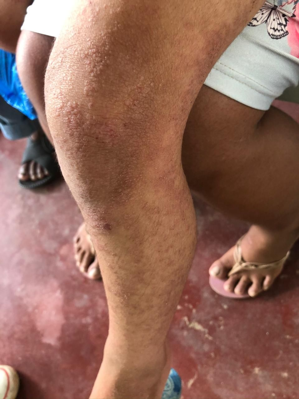 Larissa Cau Carlet-14