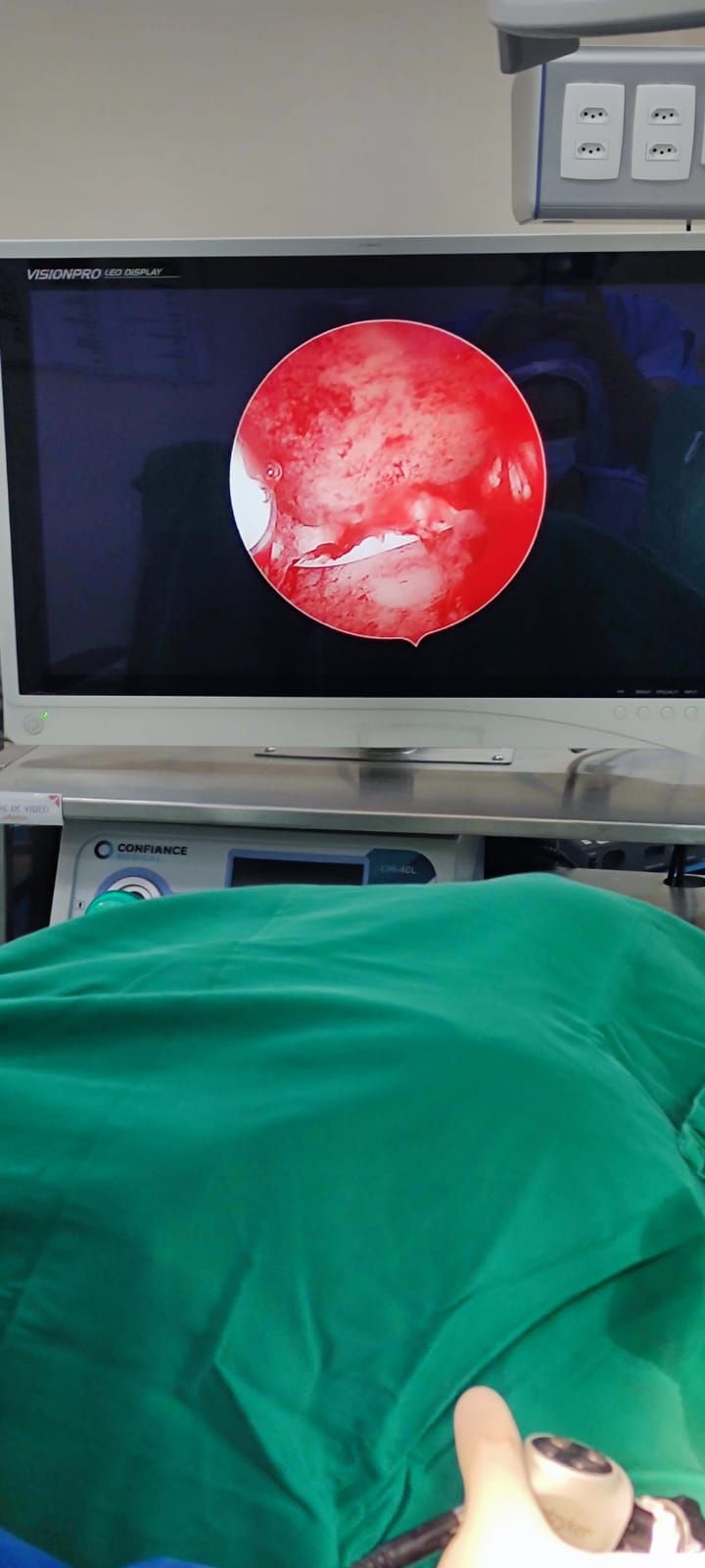 Felipe Bezerra Frota-2