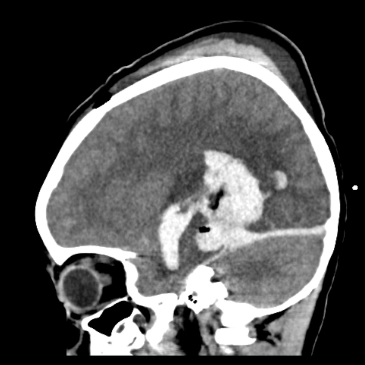 David Tafur Muñoz-1908