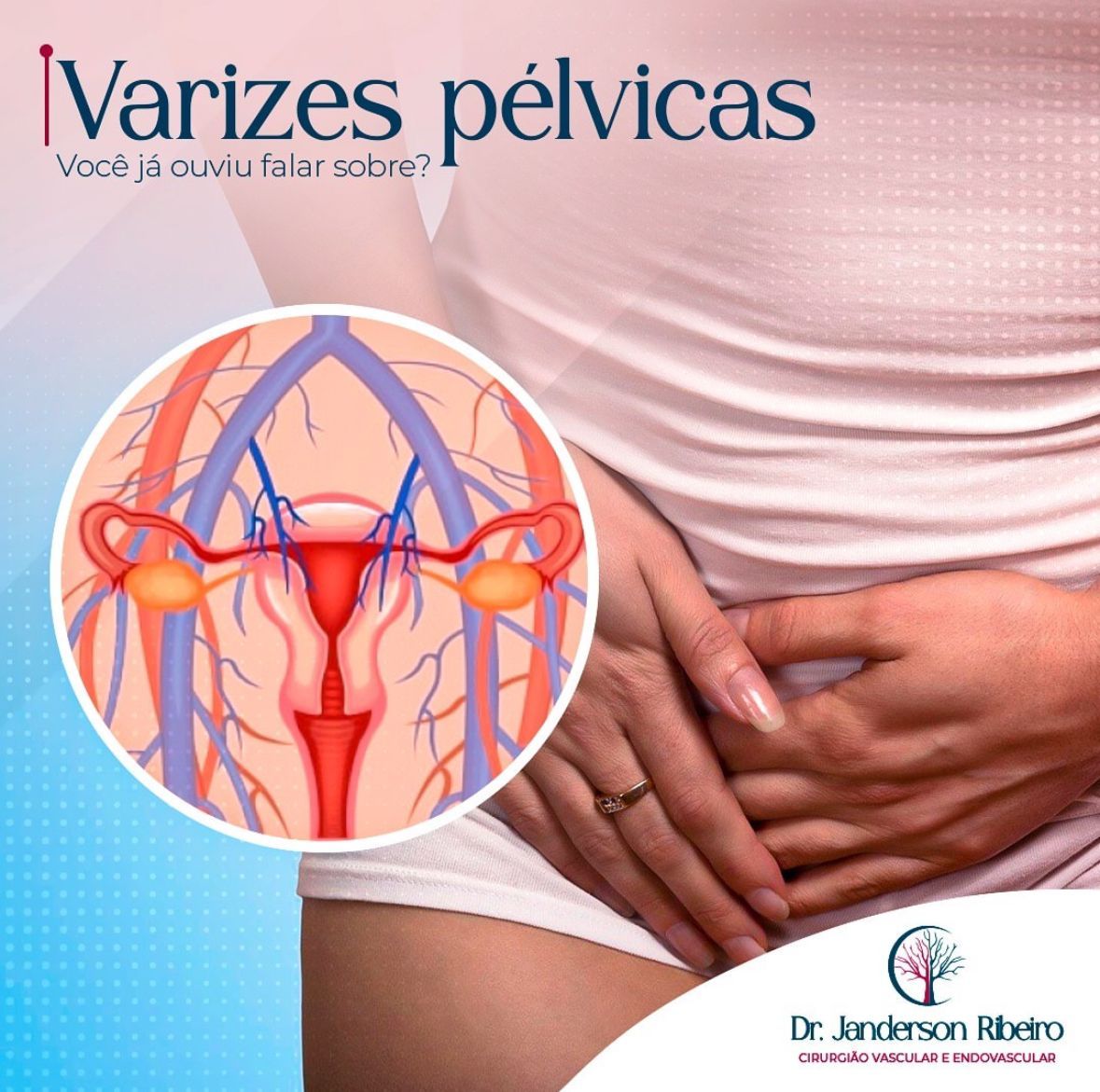 Janderson Ribeiro Fernandes-19