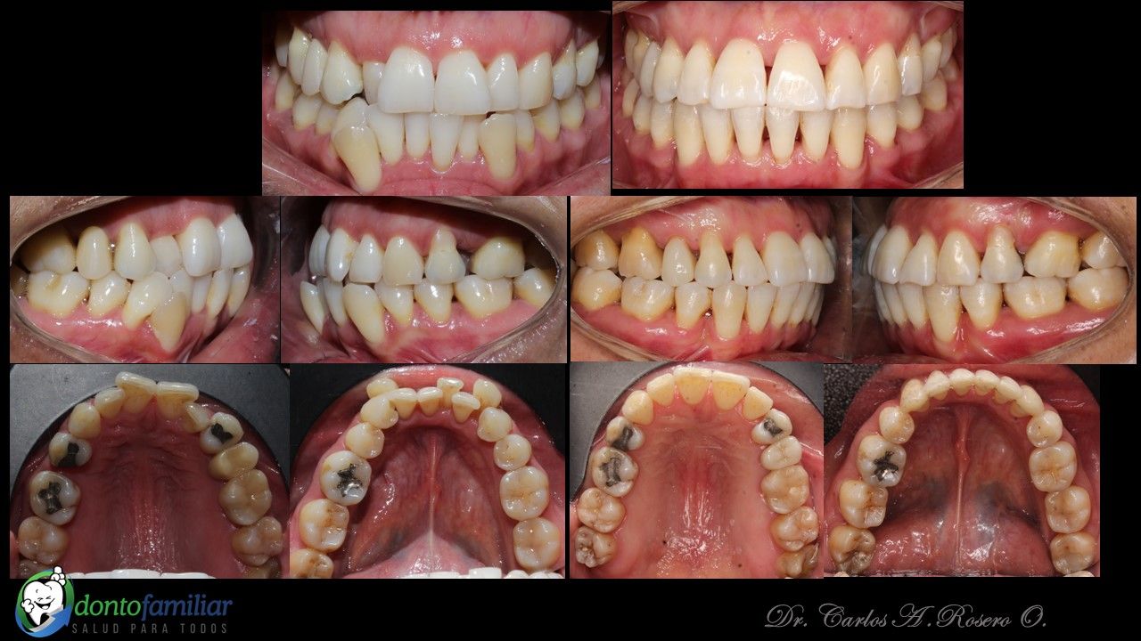 Carlos Augusto Rosero Ordoñez-1