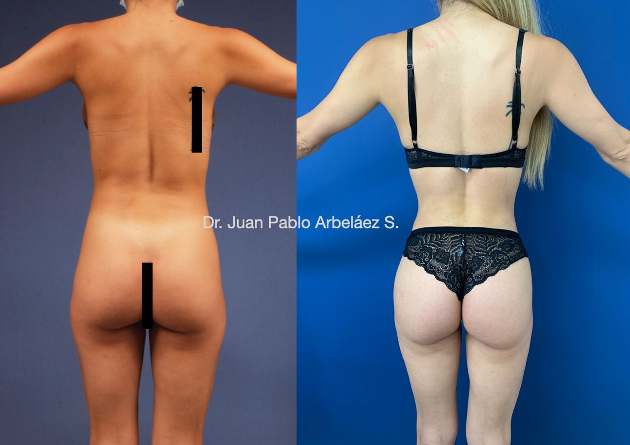 Juan Pablo Arbeláez Sierra-25