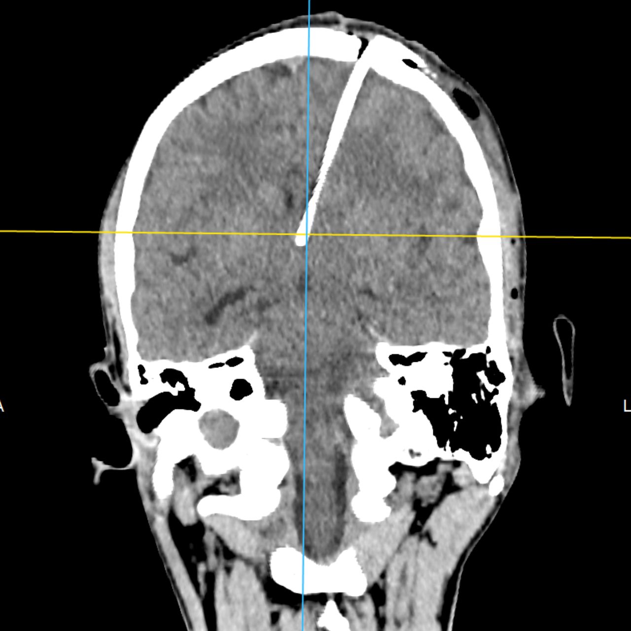 David Tafur Muñoz-1858