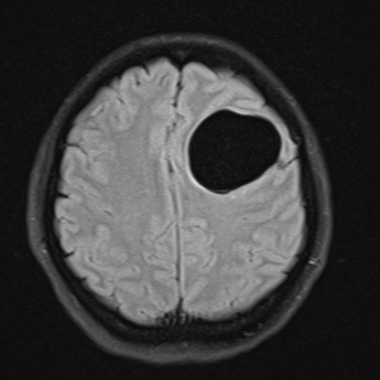 David Tafur Muñoz-1862