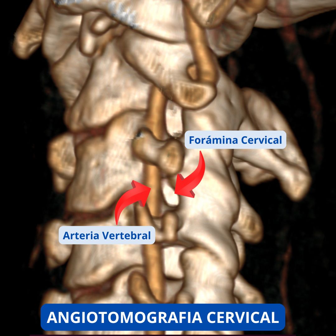 David Tafur Muñoz-2262