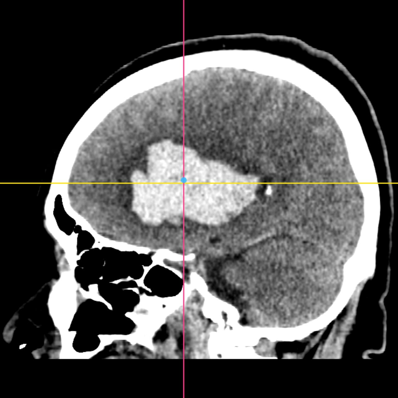 David Tafur Muñoz-1907