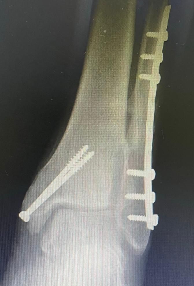 Jônatas Laurindo Giacomini-20