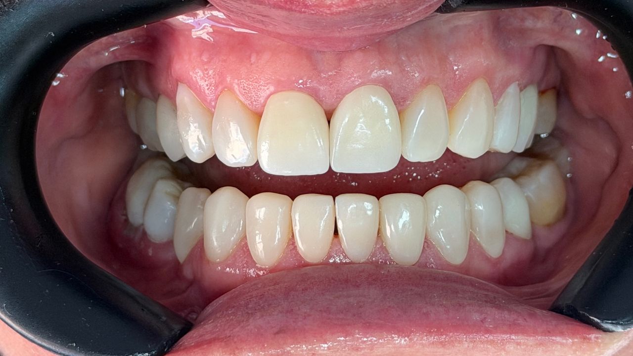 Melissa Vargas Castellanos-46