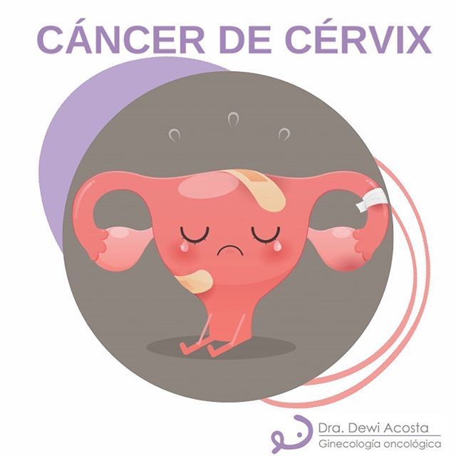 Dewi Acosta Mendoza-18