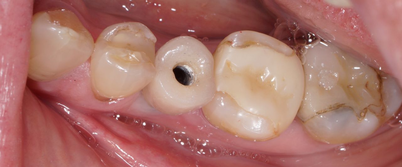 Hernán Andrés Febre Moscoso-19