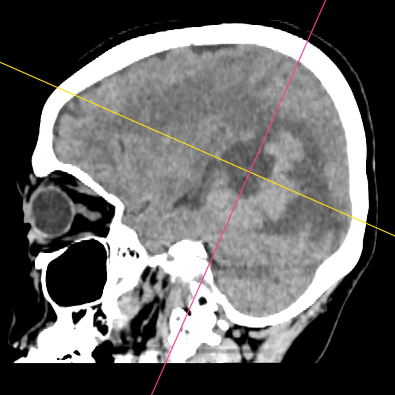 David Tafur Muñoz-1834