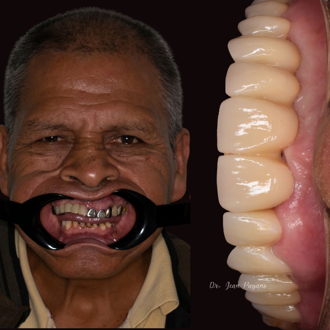 Jean Carlos Payano Arcos-2