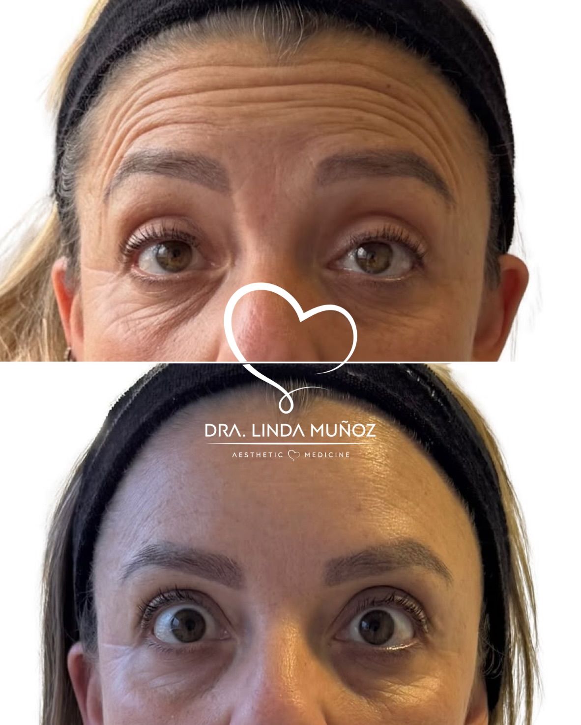 Linda Muñoz-43