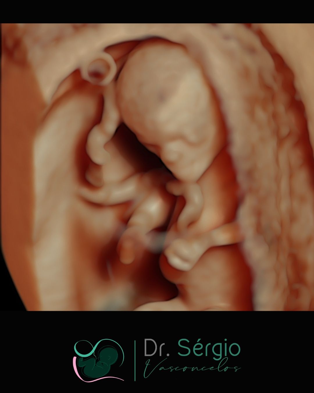 Sérgio De Abreu Vasconcelos Neto-13