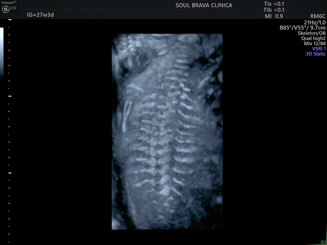 Charles Schwantz De Lima-35