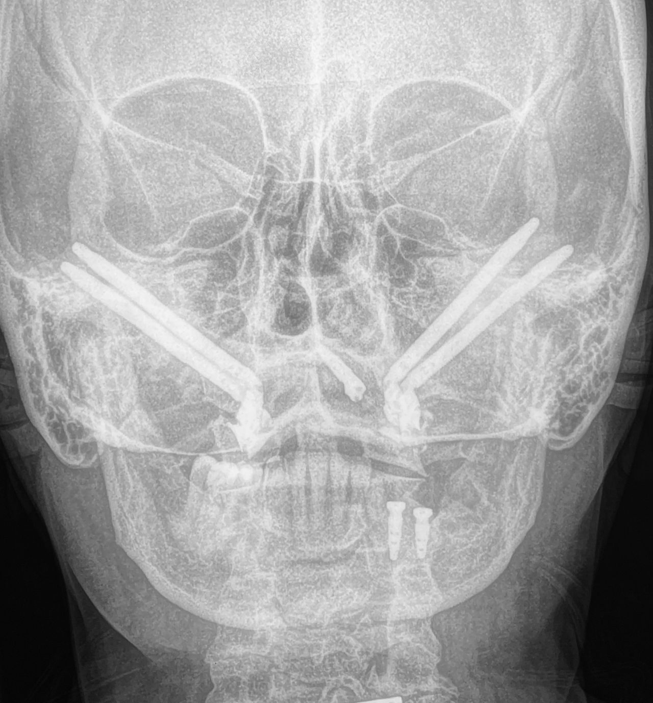 Jose Vicente Rocha Fernandez-44