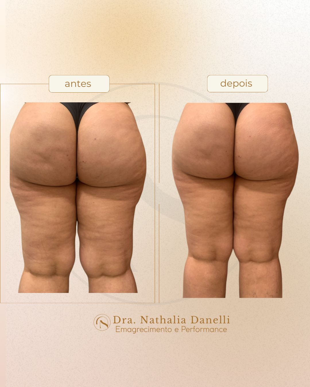 Nathalia Danelli Martinez Lopes-21