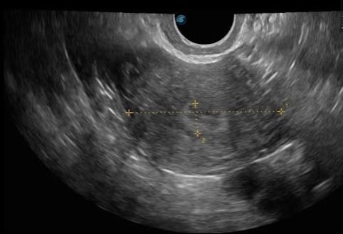 Arisev Maria Figueroa Ramos-8