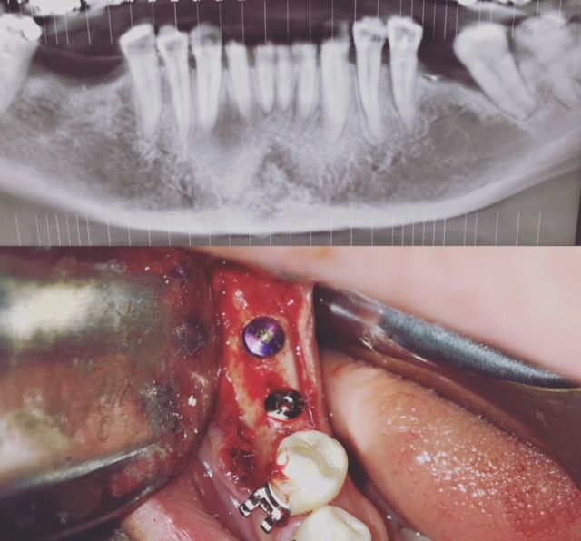 Veronica Maria Barquero Figueroa-13