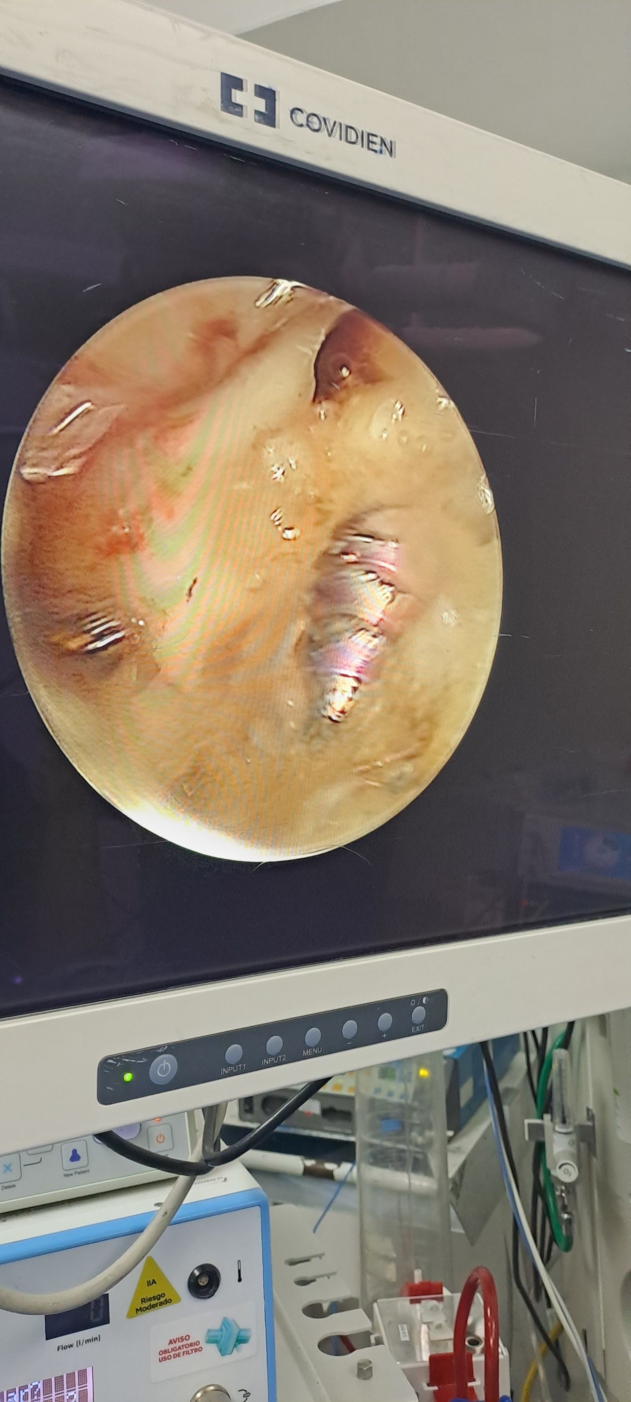 Robinson Andrés Mantilla A.-4