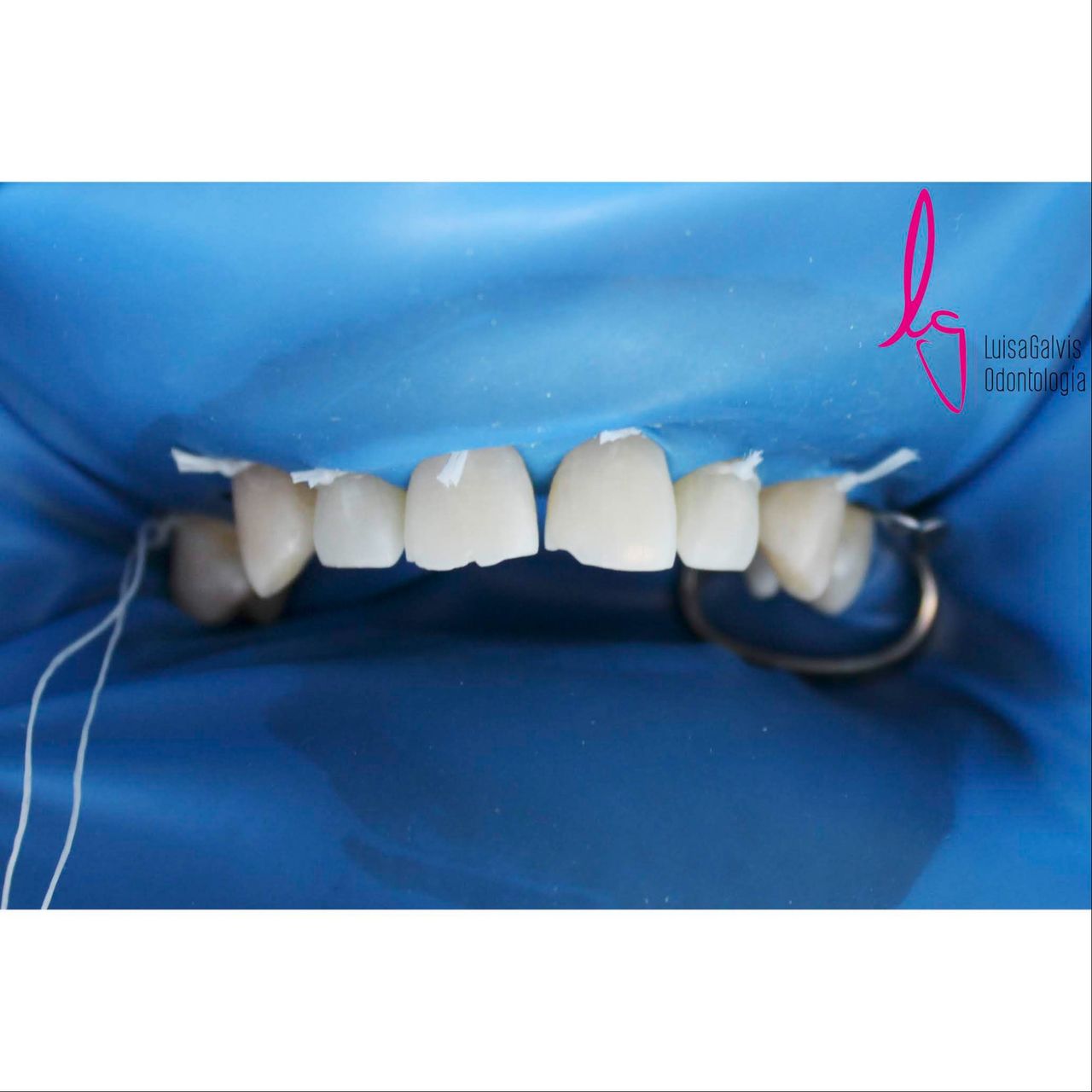 Luisa Fernanda Galvis Arcila-22