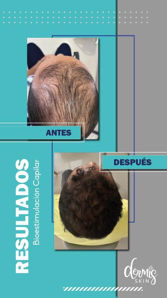 Carlos Alberto Ceron Gomez-6