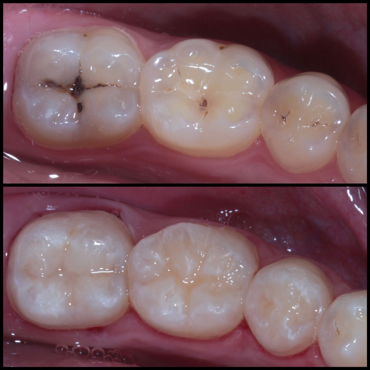 Daniel De Souza Pereira-81