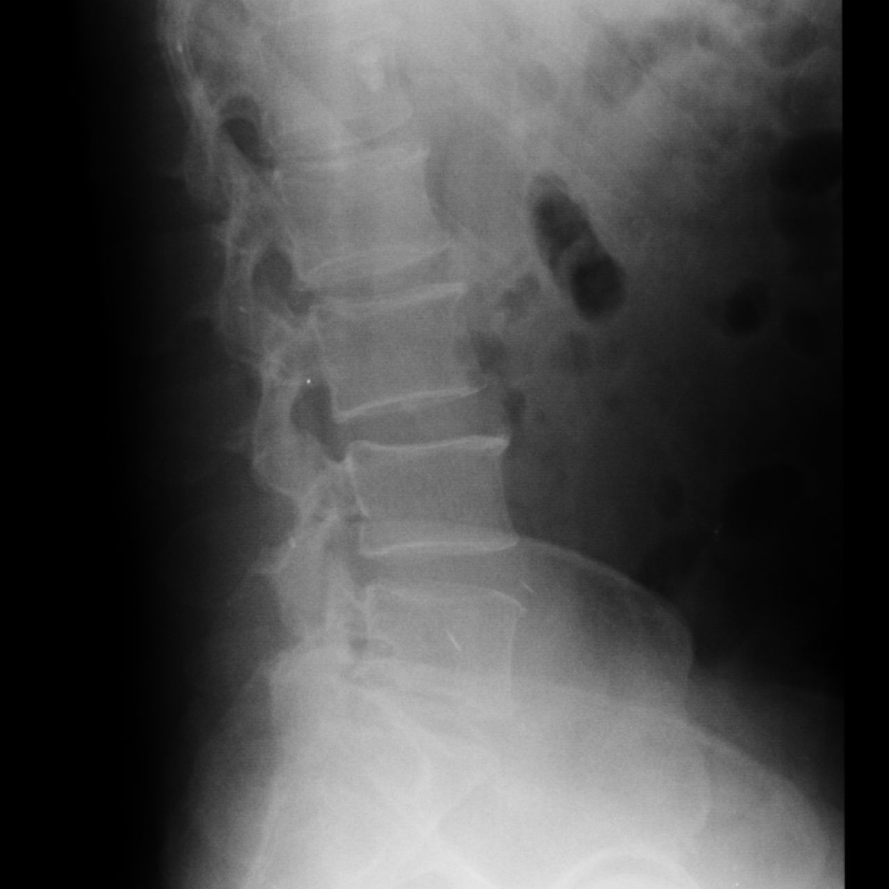 David Tafur Muñoz-1553