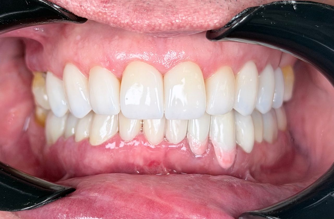 Melissa Vargas Castellanos-36