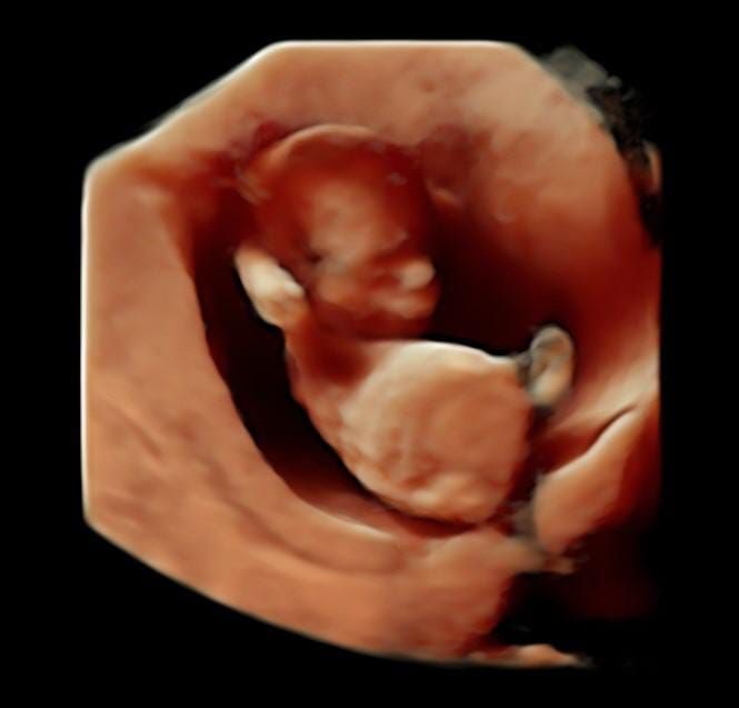 Lady Tatiana Duarte Lopez-5