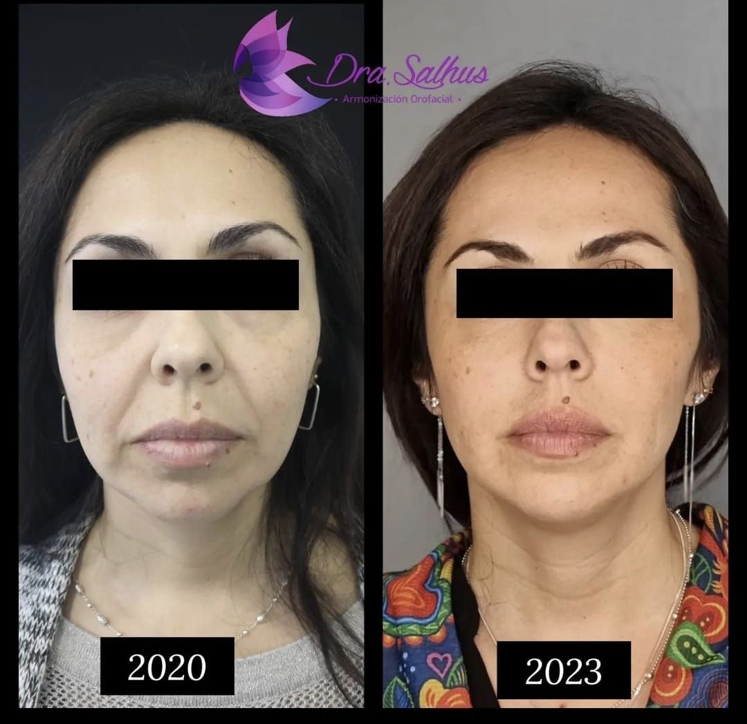 Sandra Salhus Blesa-0