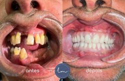 Lorenzo Mendonça Pinto-2