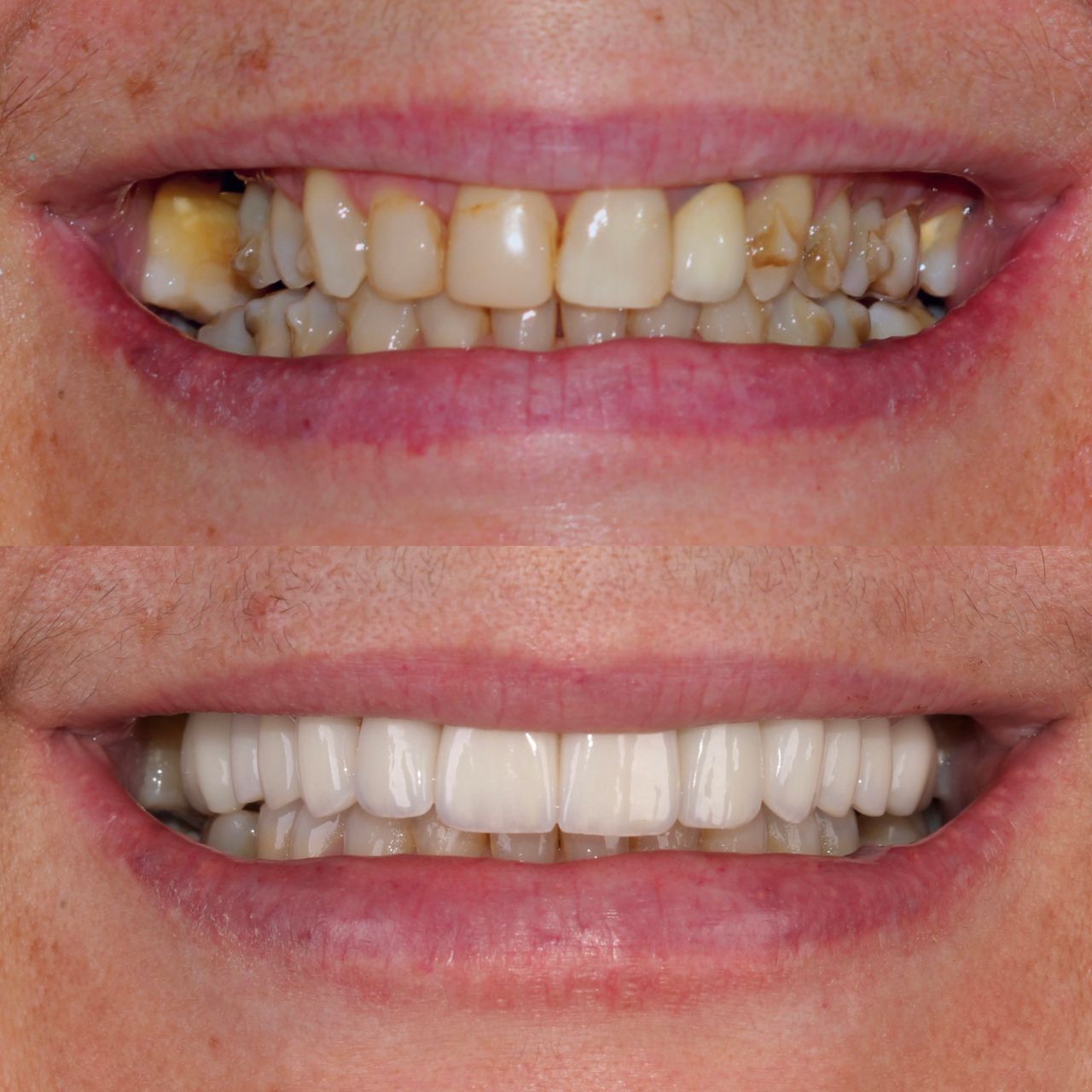 Caroline Benedeti-33